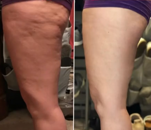 Legs
