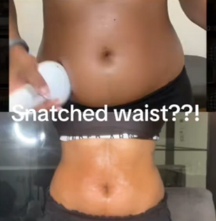 Abdomen