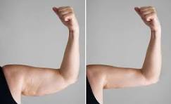Arms